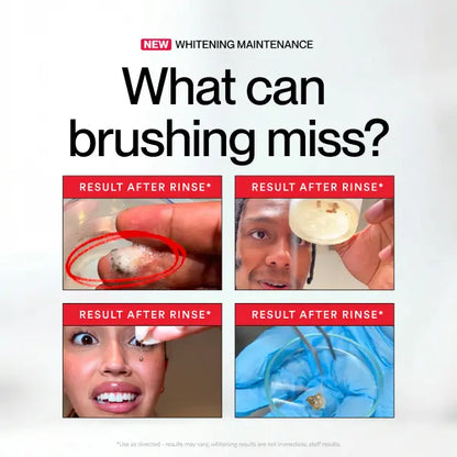 Stain Whitening Mouthwash – Hydrogen Peroxide for Fast Whitening & Deep Stain Removal
